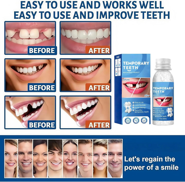 Temporary Tooth Filling Repair Kit,Denture False Teeth Repair Beads for Missing or Broken Tooth,Moldable False Teeth Replacement,Broken Tooth Repair Kit,Teeth Gap Filler,Friendly to User,Multiple Use