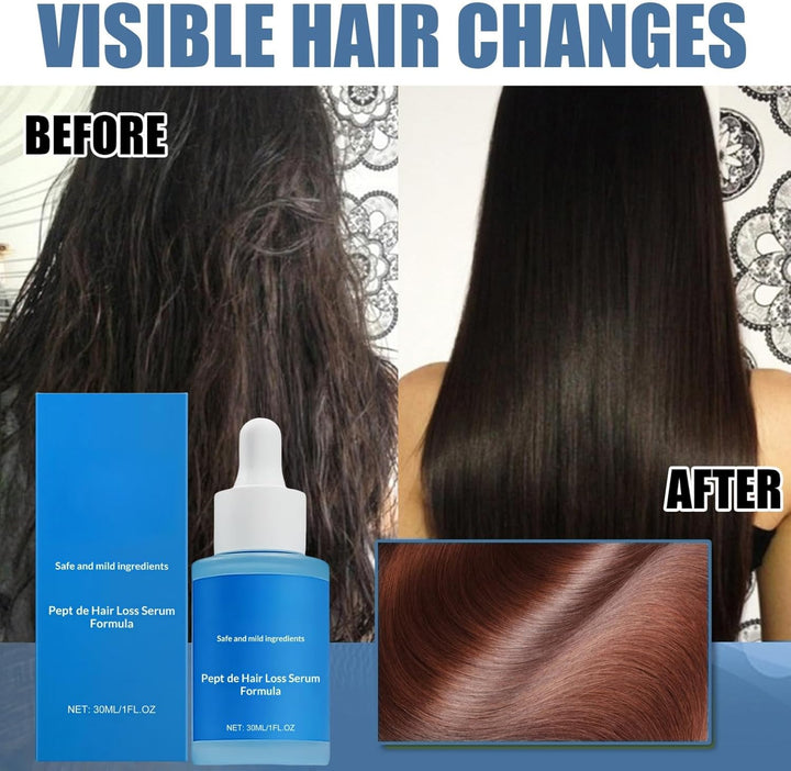 Peptonix Hair Serum Hair Growth,Peptonix Copper Peptide Ser/Um Hair,Hair Serum for Men,Hair Oil for Dry Damaged Hair,Reduces Hair Loss,Promotes H/Air Regrowth,Get Stronger H/Air