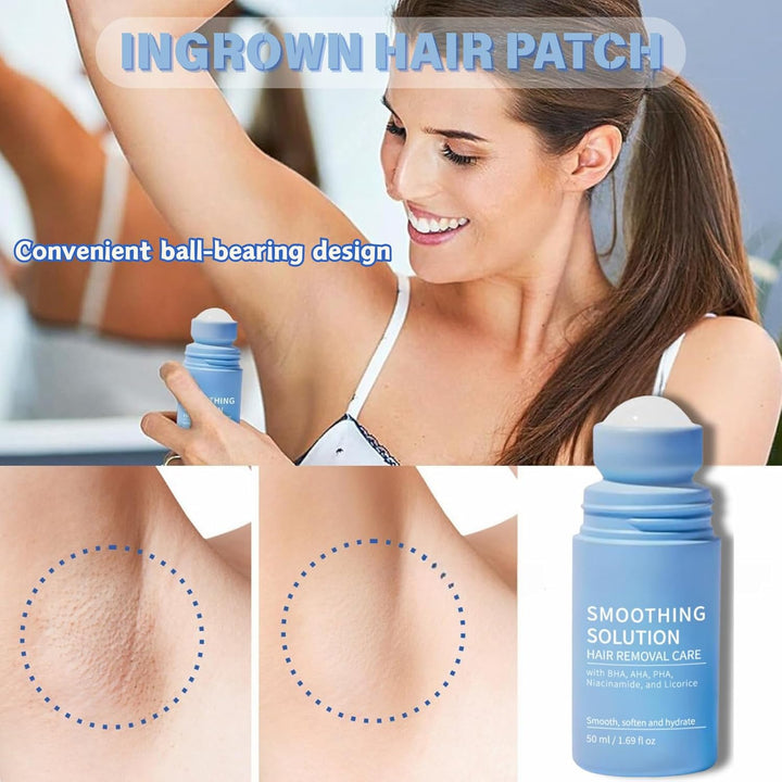 2Pcs Razor Bump Smoothing Solution Ingrown Hair Treatment with BHA AHA - High Roller Ingrown Tonic for Underarms Abdomen - Ingrown Hair Serum for Men & Women - Roller Ball Applicator for Tend Skin