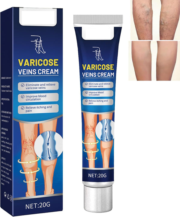 Leg Varicose Ointment,Varicose Vein Gel,Varicose Vein Removal Cream,Vein Relief Cream for Pain Relief, Natural Varicose,20G
