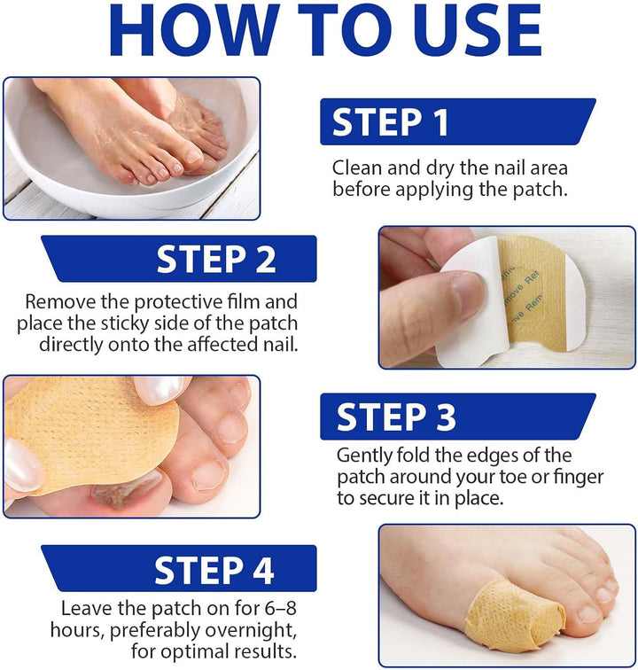 Fungal Nail Patches, 32Pcs Toe Nail Fungal Treatment Pads, 8-Hour Nighttime Toenail Fungus Treatment Restores Healthy Appearance, Reduces Discoloration & Thickness, Overnight Repair for Damaged Nails