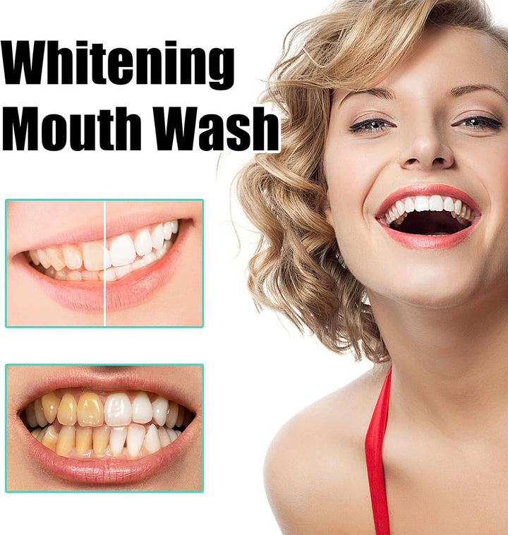 Coconut Mint Mouthwash - Whitens Teeth, Reduces Plaque and Bad Breath | Alcohol-Free, Includes Tongue Scraper | 100Ml Ayurvedic Oral Care Set