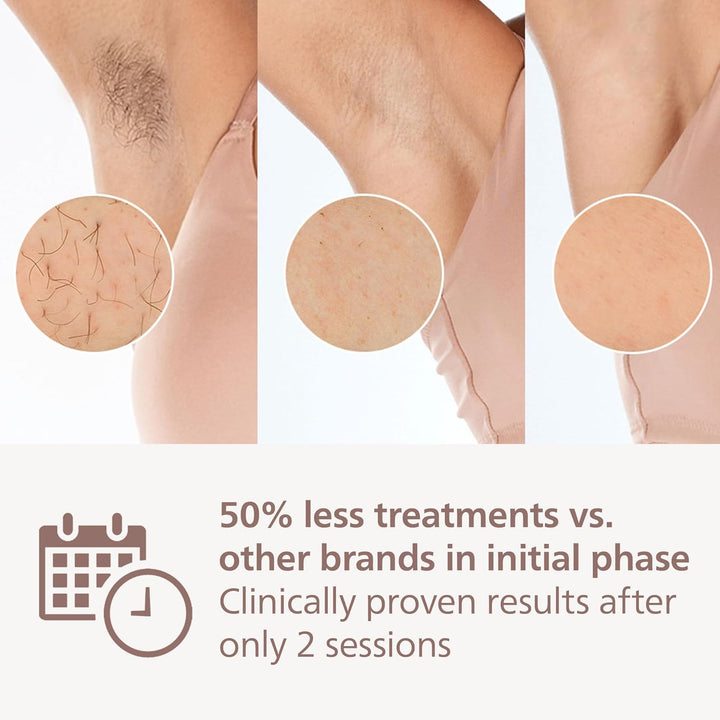 Lumea 8000 Series, IPL Hair Removal Device, Laser Hair Removal Alternative, Senseiq Technology, 2 Attachments for Body and Face, Model BRI944/00