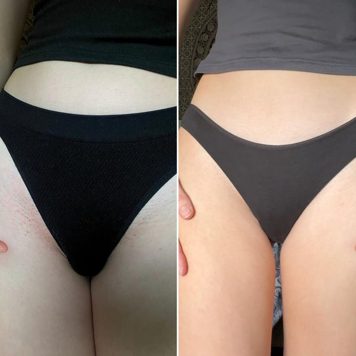 Healing Intimate Oil for down There | Ingrown Hairs, Razor Bumps after Shaving Bikini Line | Fragrance-Free Natural Itch Relief for Dry Skin | UK Made Vegan & Cruelty-Free Skincare | 30Ml