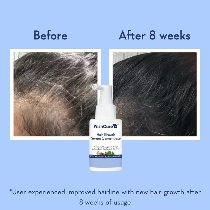 Hair Growth Serum with Rosemary, Redensyl, Anagain, Baicapil, Caffeine, Biotin