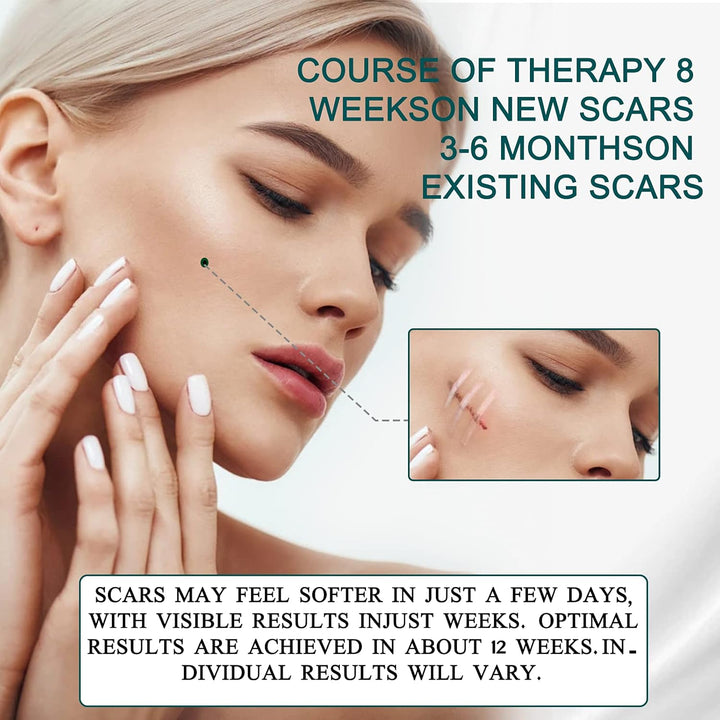 Silicone Scar Sheets, Silicone Scar Tape (1.6” X 120”Roll-3M), Scar Tape Roll Medical Silicone Easy-Tear Gel Tape Roll, Scar Removal Sheets Works on Old & New Scars, Scar Treatment Sheets