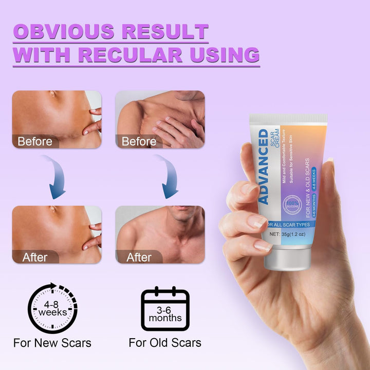 Silicone Scar Gel Scar Cream, Advanced Scar Removal Cream - Reduces the Appearance of C-Section, Injury, Stretch Marks, Acne, Burns, Keloids, Old & New Scars, 35G (1.2Oz)
