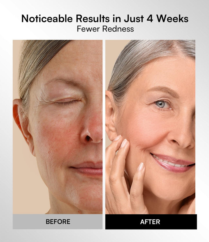 LED Face Mask – Red Light Therapy Mask with 4 Light Modes, 850Nm NIR, Red & Blue Led Mask Light Therapy, 220 Beads, Rechargeable Infrared Mask Wavelength for Acne, Anti-Ageing, Skin Care, Wrinkle