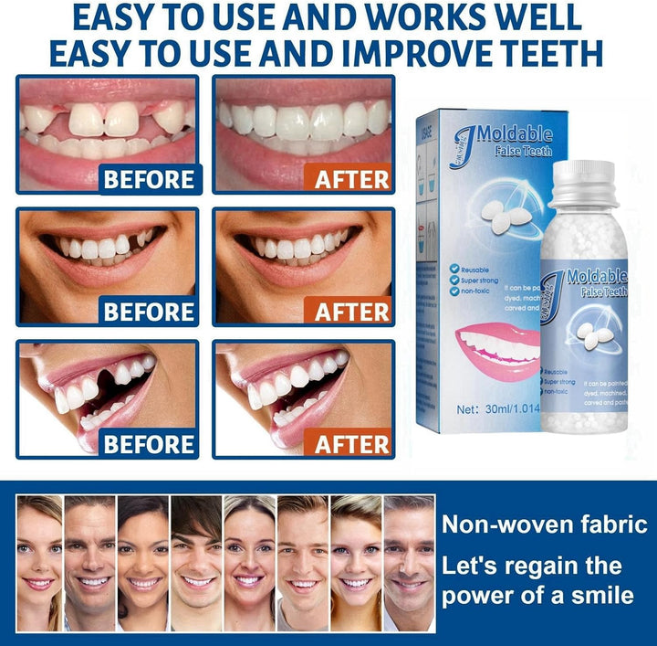 Temporary Tooth Filling,Repair Beads Tooth Repair Kit,Moldable False Teeth,Tooth Filling Repair Kit,Filling Kit for Teeth,Diy Tooth Repair Granules,Dental Repair Kit Filling,Broken Tooth Repair