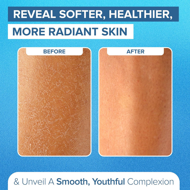 DEEP Exfoliation Body Exfoliator Mitt for Dead Skin Removal (1 Glove)  Exfolimitt Exfoliating Glove for Smooth, Healthy & Glowing Skin - Washable, Quick-Drying & Gentle on Skin