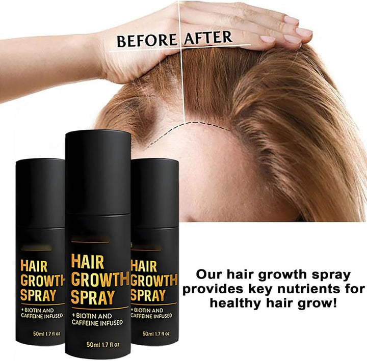 Hair Growth Spray, Biotin Hair Thickening Spray for Thinning Hair, Supports Fuller & Stronger Hair for Women & Men (1)