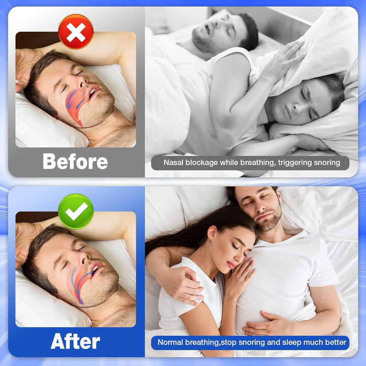 Nasal Strips-80 Pieces Nose Strips for Breathing,Sleep Aid & Snoring Relief,Physically Lifts Nose to Improve Breathing,Eases Congestion,Drug-Free Nasal Strips,Snoring Aid for Men & Women