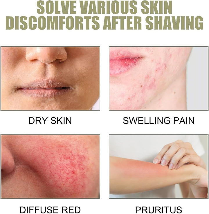 After Shave Soothing Roll on Serum,Smoothing Solution Ingrown Hair Treatment,Ingrown Hair Serum Roll On,After Shave Oil,Razor Bumps Treatment for Women Underarm/Face/Neck/Leg,Gently Cleanses Armpits