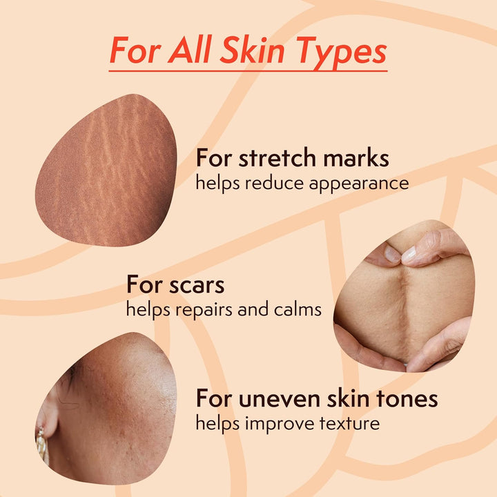 Stretch Mark Body Oil, Strengthens Skin Elasticity & Helps with the Appearance of Stretch Marks and Scars, Infused with Vitamin E, Vegan, 100Ml