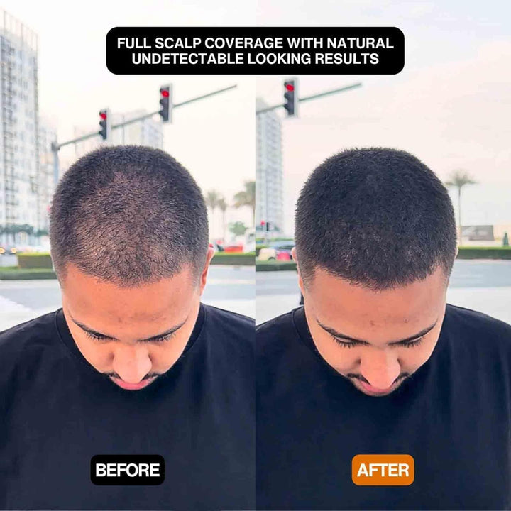 Hairbear Hair Filler, Hairbear Hair Filler Powder, Will Cover up Any Thinning Areas, Blissaehair Filler Powder, Hairlinepowder Stick Root Cover up for Women and Men (Black, 1)