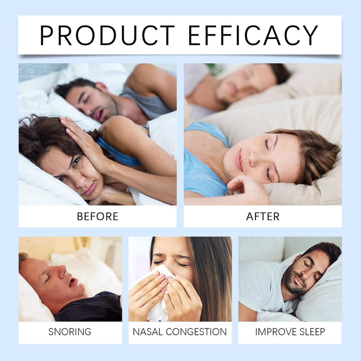 Nose Strips for Sleeping, Nose Breathing Strip | 36 X Nose Strips for Breathing Sleeping - Ventilation Nasal Strips, Nose Strip for Better Sleep, Respiratory Strips Relieve the Nose With