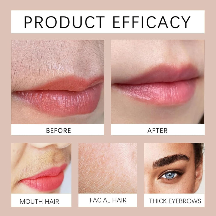 Hydrating Derm/Aplane Oil,Face Shaving Oil for Women,Facial Hair Remover for Women,Hair Inhibitor,Ingrown Hair Remover,Deep Moisturizing & Hydrating,Gently & Non-Irritating,With Jojoba & Vitamin E