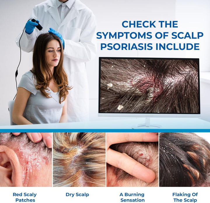 Psoriasis Scalp Treatment Cream - Extra Strength for Scalp Psoriasis Folliculitis - Controls Itching Flaking Stubborn Dandruff 3.4 Oz