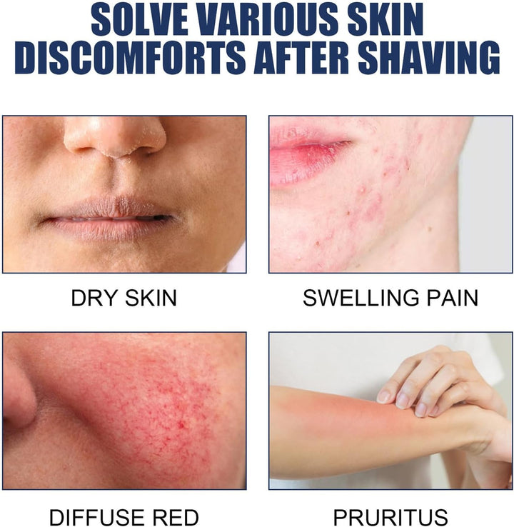 Razor Bumps Treatment for Women and Men, after Shave Solution Roll-On for Ingrown Hairs, Razor Bump Treatment for Face,Neck, Legs, and Underarm Area, Ingrown Hair Serumazor，Smooth Skin(90Ml)