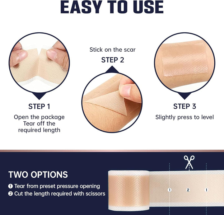 Silicone Scar Tape 4Cm X 1.5M | Medical Grade Silicone Sheets for Scar Care | Suitable for Surgery, C Section, Burns, Acne Marks and Stretch Marks | Soft, Reusable, Waterproof