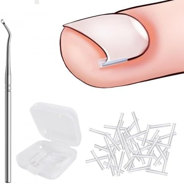 40 Pcs Ingrown Toenail Correction Strips, Toenail Straightener Strips, with Toenail Lifter, Ingrown Toenail Treatment Kit, Toenail Recover Clips, for Women Men Foot Care