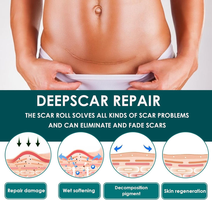 Silicone Scar Sheets, Premium Silicone Gel Scar Tape, Reusable Silicone Patches, Painless Silicone Tape Roll, Silicone Scar Tape for Surgeries Scars, C-Sections, 1.6'' X 120''Roll-3M