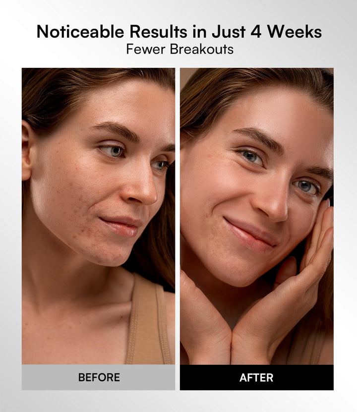 LED Face Mask – Red Light Therapy Mask with 4 Light Modes, 850Nm NIR, Red & Blue Led Mask Light Therapy, 220 Beads, Rechargeable Infrared Mask Wavelength for Acne, Anti-Ageing, Skin Care, Wrinkle