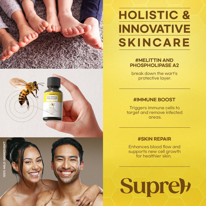 Fast-Acting Bee Venom Wart Remover: Wart Freeze off with Salicylic Acid & Bee Venom Cream - Wart Removal for Plantar Wart Genital Wart Common Wart on Face Hand Finger 30