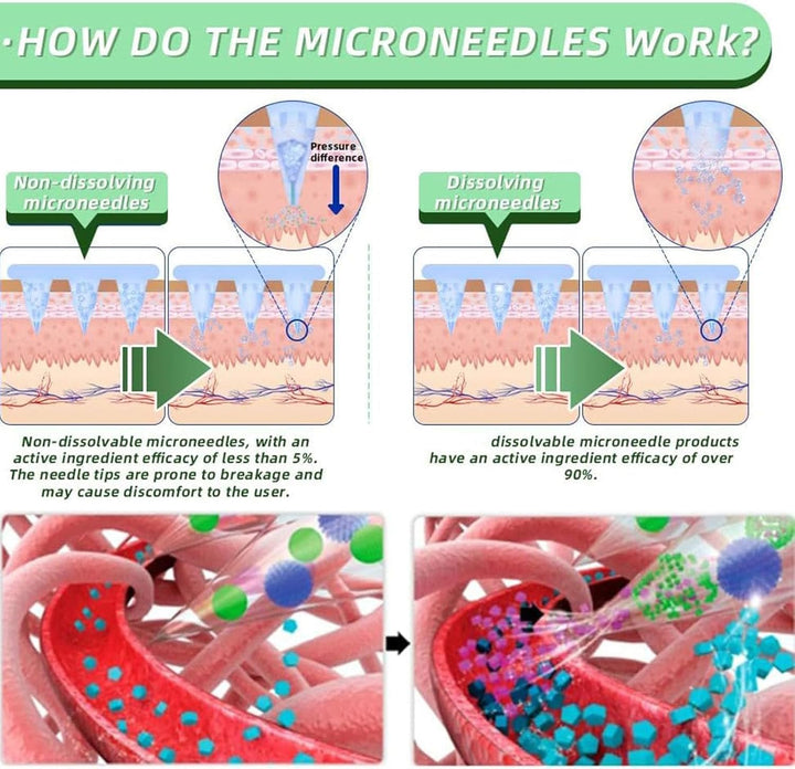SMGT-GLP-1 Nano Microneedle Patch, Nano Micro Needle Patch, Long-Lasting GLP-1 Microneedlepatch, Glp-1 Patches for Women and Men(3Boxes)
