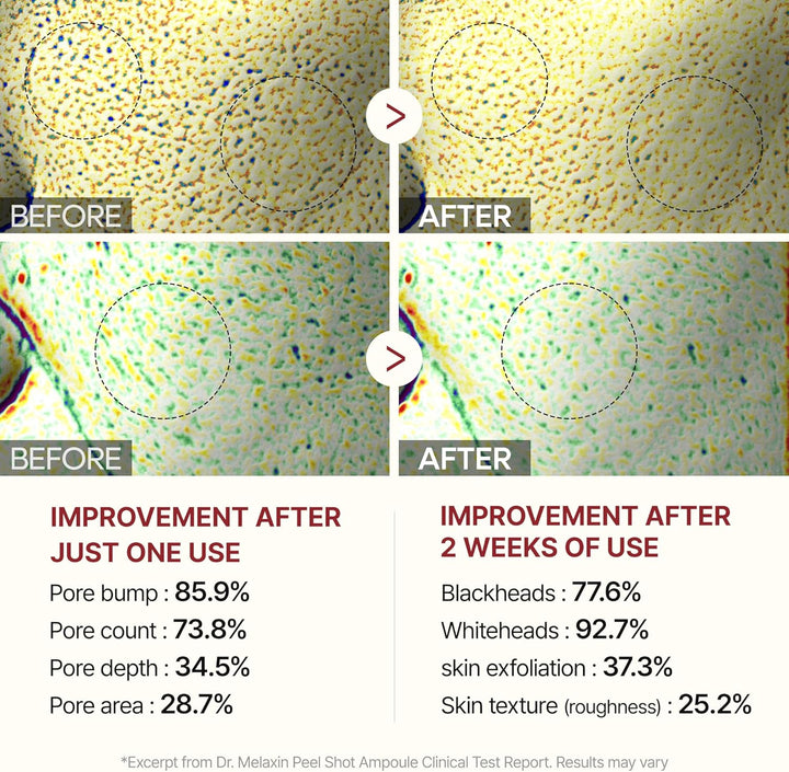 Peel Shot Glow Black Rice Peeling Ampoule Soft Exfoliating Face and Body Scrub Dead Skin Cells Blackheads Remover for All Skin Types Korean Skin Care 80Ml