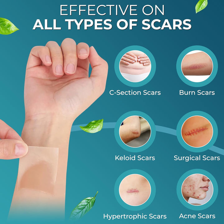 Medical Grade Silicone Scar Tape | 4Cm X 1.2M | Silicone Scar Sheets for after Surgery C Section Recovery, Wrinkles Removal, Face Treatment Gel Patches/Plasters