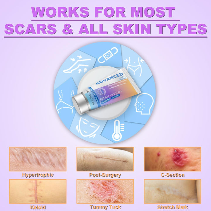 Silicone Scar Gel Scar Cream, Advanced Scar Removal Cream - Reduces the Appearance of C-Section, Injury, Stretch Marks, Acne, Burns, Keloids, Old & New Scars, 35G (1.2Oz)