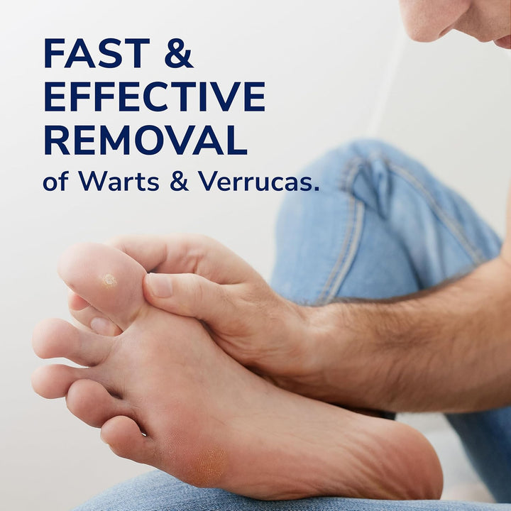 Wart and Verruca Removal Plasters, Pack of 21, Fast and Effective Verruca Treatment and Wart Remover, Immediate Pain Relief, Washproof Plasters