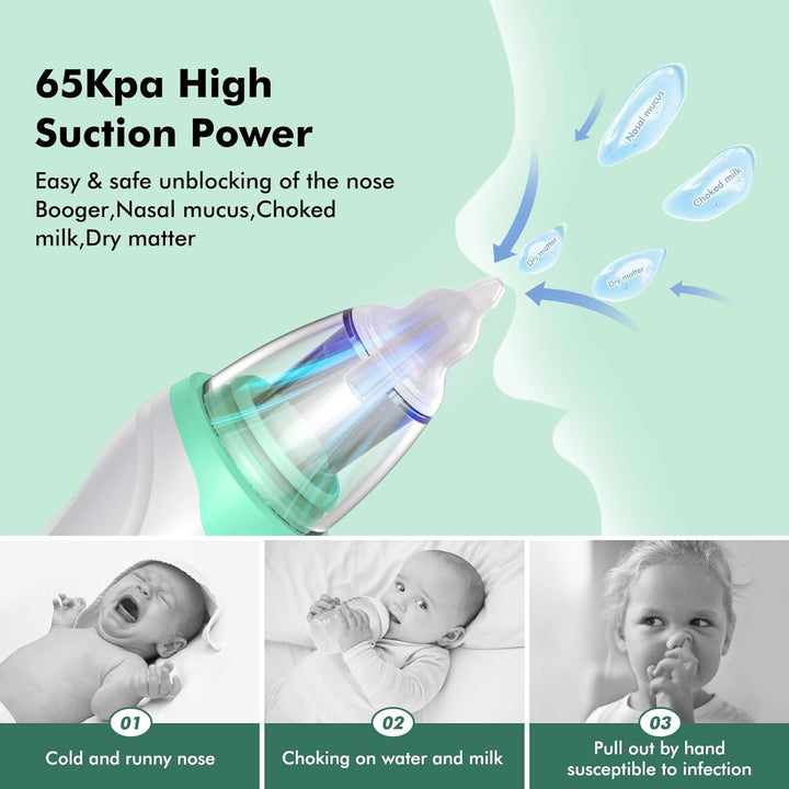 Nasal Aspirator Baby, Electric Nose Suckers, 3 Silicone Tips and 3 Suction Levels, Anti-Backflow Snot Sucker for Newborns, Toddlers, Soothing Function with Music and Light