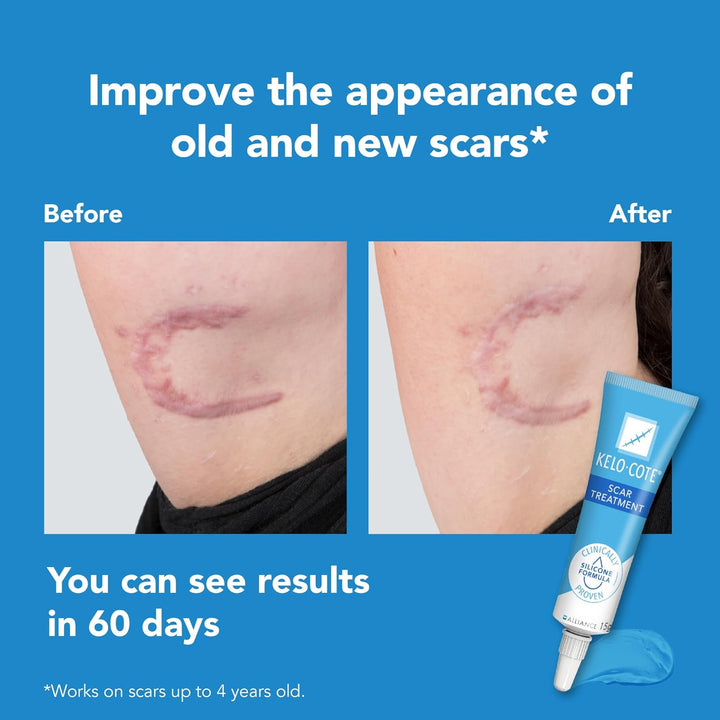 Scar Gel 6G | Silicone Scar Gel Formula | Helps Improve the Appearance of Old & New Raised Scars | Reduces Redness, Itching & Discomfort | Ideal for Surgical, C-Section, Burn & Acne Scars