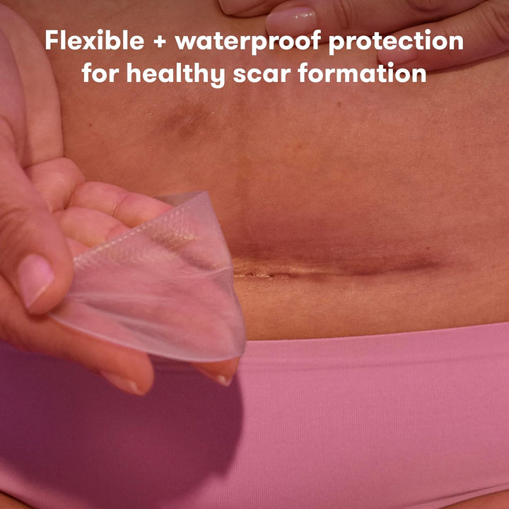 C-Section Silicone Strips: C-Section Recovery Must Have Scar Patches, Reusable Medical Grade Treatment for Keloid Scars, 20Cm Length, 6 Count + Keep-Clean Case