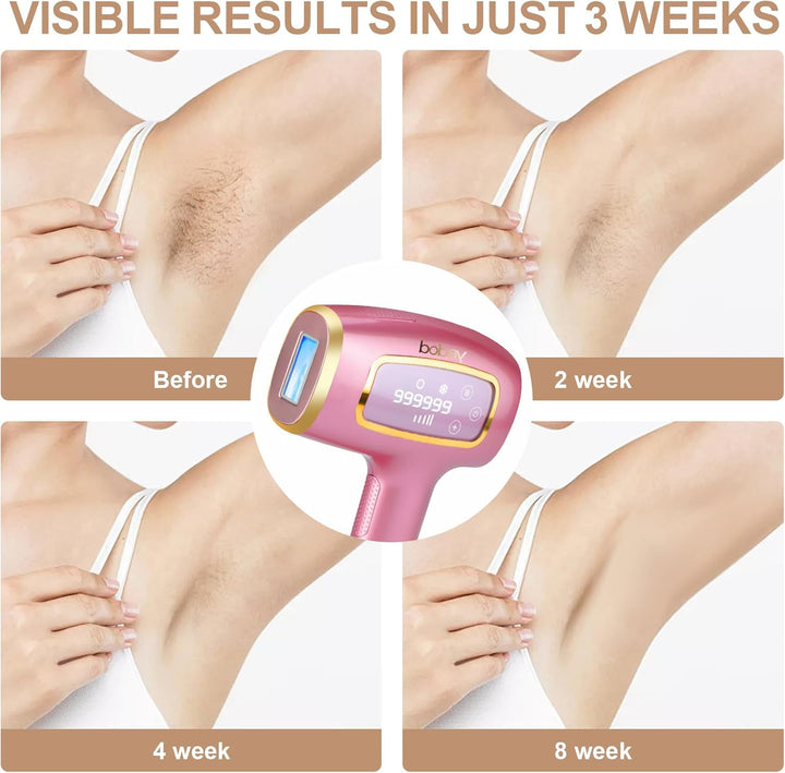 IPL Laser Hair Removal Device for Women, Ice-Cooling Painless Permanent IPL Hair Removal, 999,990 Flashes for Legs Arms Armpit Body Bikini, at Home Handheld Laser Hair Remover Epilator