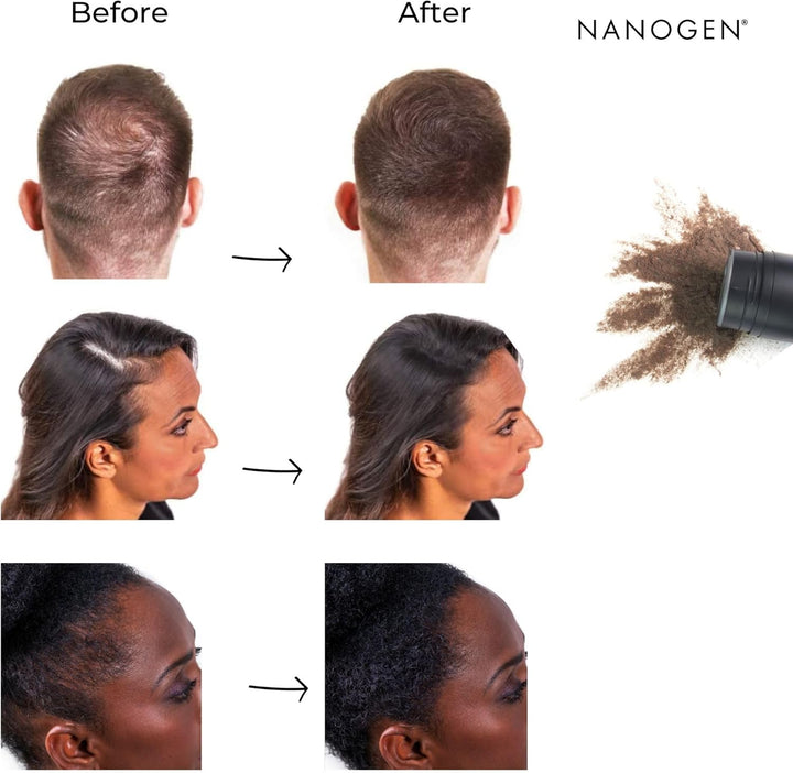 Hair Fibres, 30 G, Dark Brown