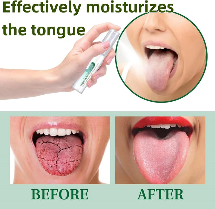 Tongue Repair Spray,So/Re Tongue Relief,Breath Freshener Spray,So/Re Mouth and Ton-Gue Treatment,Remove White Dirt,Instant Dry Mouth Relief,Moisturizing,Natural Ingredients,Mild and Non-Irritating