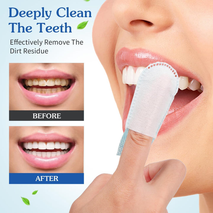 Babywipes Baby Finger Toothbrush Gauze Dental Finger Brush Oral Hygiene Cleaning Wipes 20Pcs Infant Toddler Training Teething Tools Baby Wips