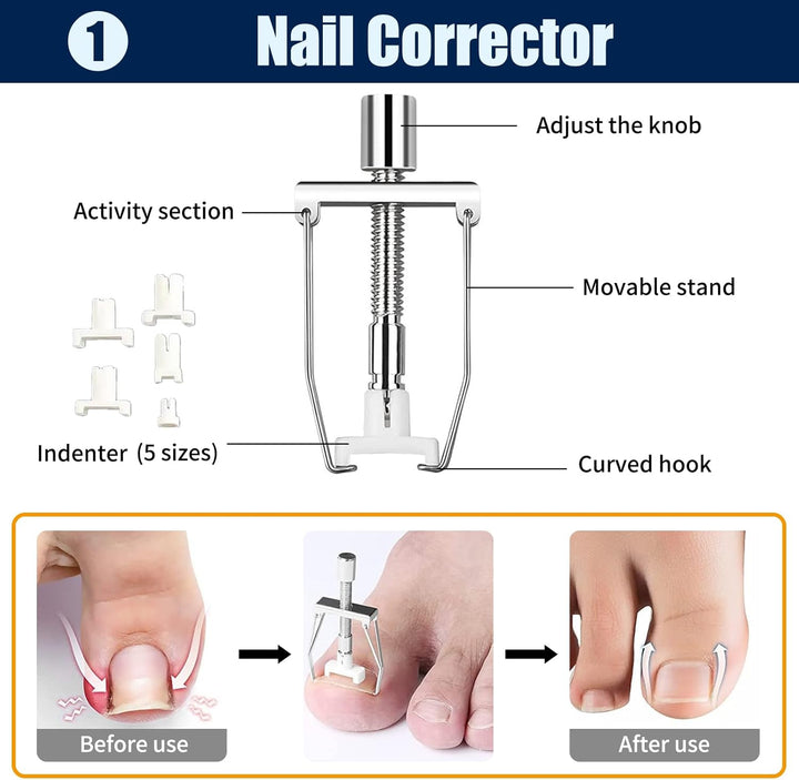 Ingrown Toenail Removal Kit Ingrown Toenail Treatment Tool Kit Ingrown Toenail Corrector Tools with Toenail Braces, Podiatry Tools, Ingrown Toenail Corrector Strips and Patch for Toe Pain Relief