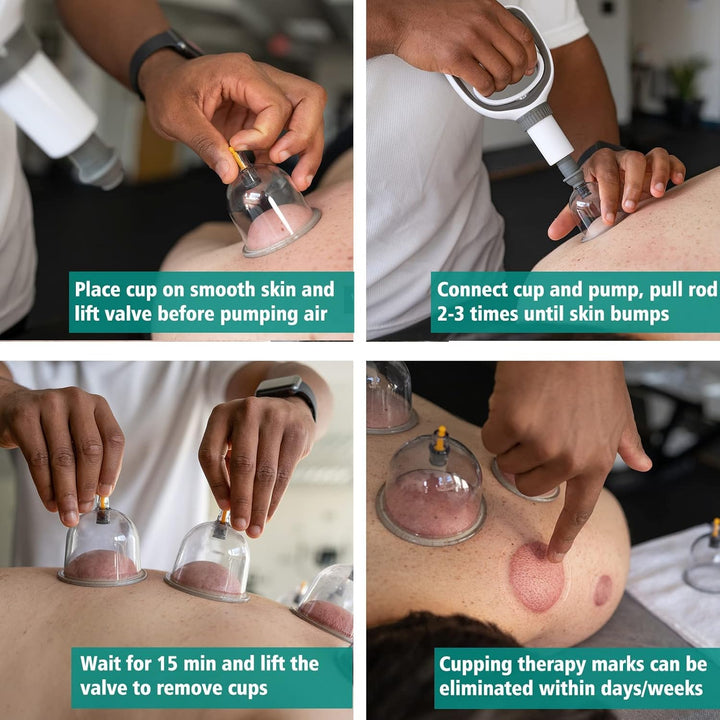 Professional Cupping Therapy Set, 18 PCS Suction Cups with Pumping Handle, Chinese Cupping Set, anti Cellulite Cupping Massage for Body and Face, Relief Muscle Tension Pain