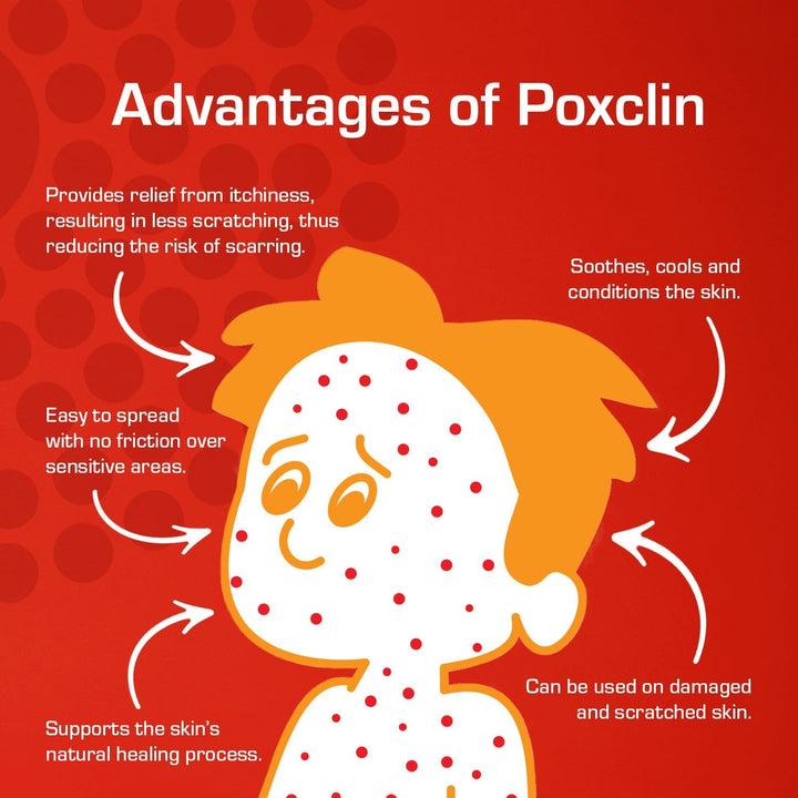 Coolmousse Chickenpox Treatment for Children, Relieve Symptoms and Itch of Chickenpox, Natural Ingredients, 100 Ml