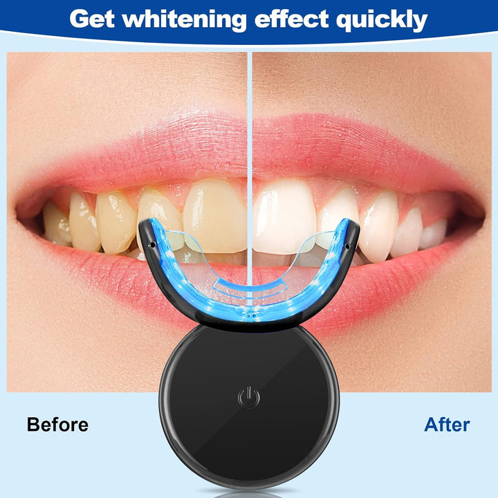 LED Teeth Whitening Kit with Dual Red Blue Light Tray & Bleaching Gel Pen - Professional Tooth Whitener for Effectively Removing Coffee, Wine, Smoking Stains for Whiter Teeth at Home