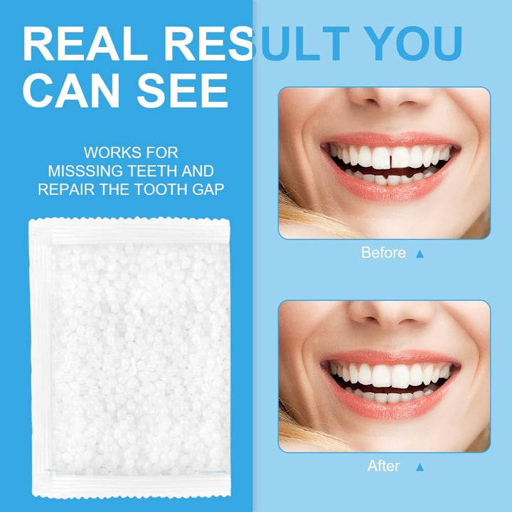 Temporary Tooth Repair Kit, 50G Temporary Tooth Filling Repair Thermal Beads Teeth Fixing Tooth Beads, Dental Tooth Filling Material for Fixing Filling Missing Broken Tooth