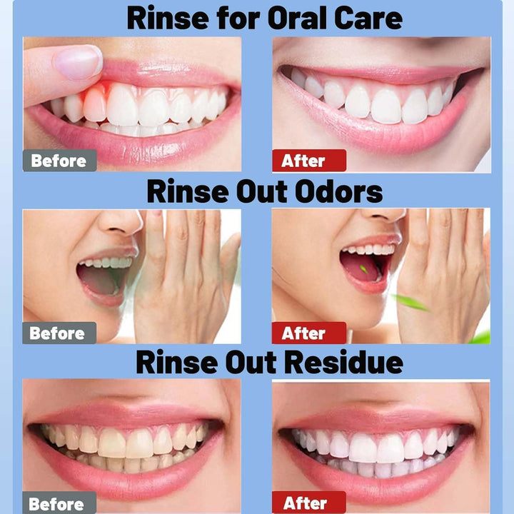 Whyte Oil Pulling Rinse, Spearmint Oils Pullings Rinse, Natural Oral Cleanse, Remove Yellow Stains and Brighten Teeth