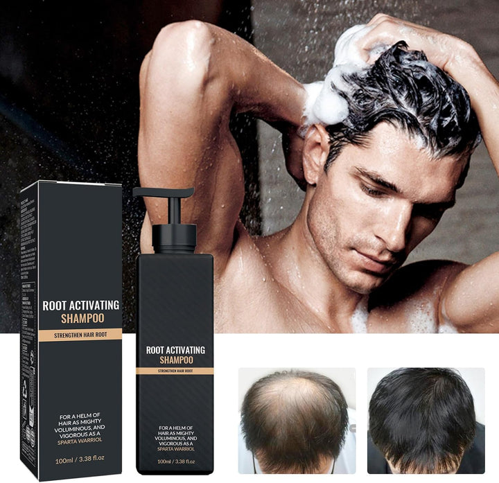 2Pcs Root Activator Shampoo,Mane Root Activator Shampoo for Man,Unisex Hair Thickeningshampoo That Repairs,Smooths & Strengthens,Hair Restoration Solution