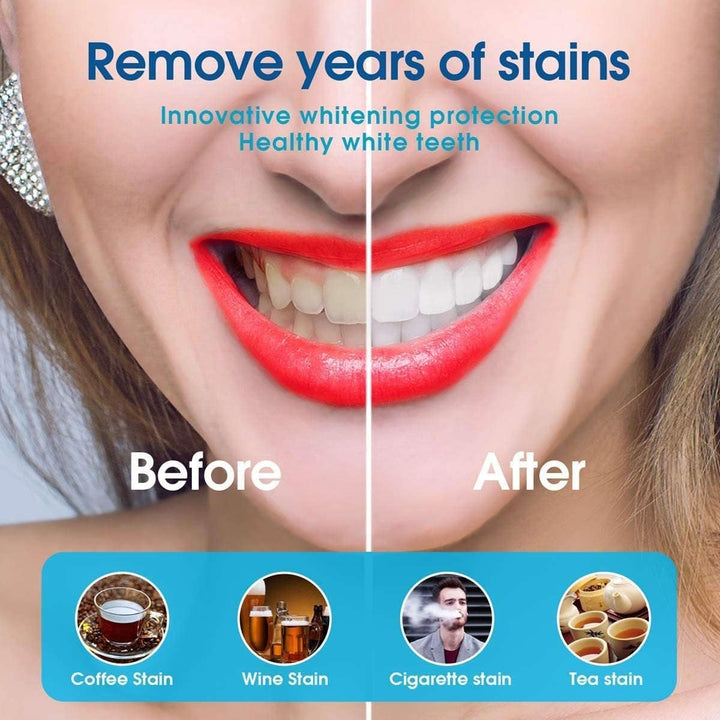 LED Teeth Whitening Kit: Home Teeth Bleaching Kit Including Tooth Whitening Gel Pen and Bleaching Light Tray - Quickly and Safely Remove Stains to Make Tooth White