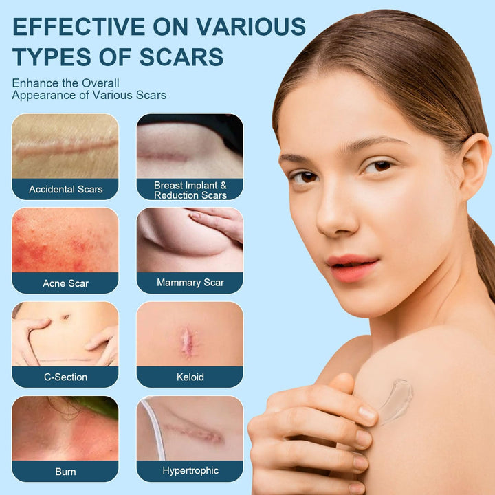 Advanced Silicone Scar Gel, Effective Scar Cream - Reduces the Appearance of Both Old and New Scars from Burns, Injury, Acne, Stretch Marks, Keloid, C-Section, and More, 1.7 Oz