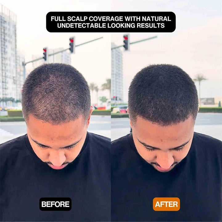 Hairbear Hair Filler Powder,Blissae Hair Filler Powder, Long Lasting Water Proof, Natural Hair Thickening Fibers Instant Volume & Scalp Coverage for Thinning Hair,Root Cover up (Black)